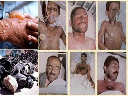 مدعیان حقوق بشر طرفدار بکار بردن سلاح های شیمیایی هستند/35 هزار جانباز سهم ایران از جنگ تحمیلی+ آمار
